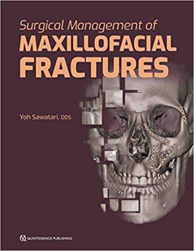 Surgical Management of Maxillofacial Fractures - Orginal Pdf